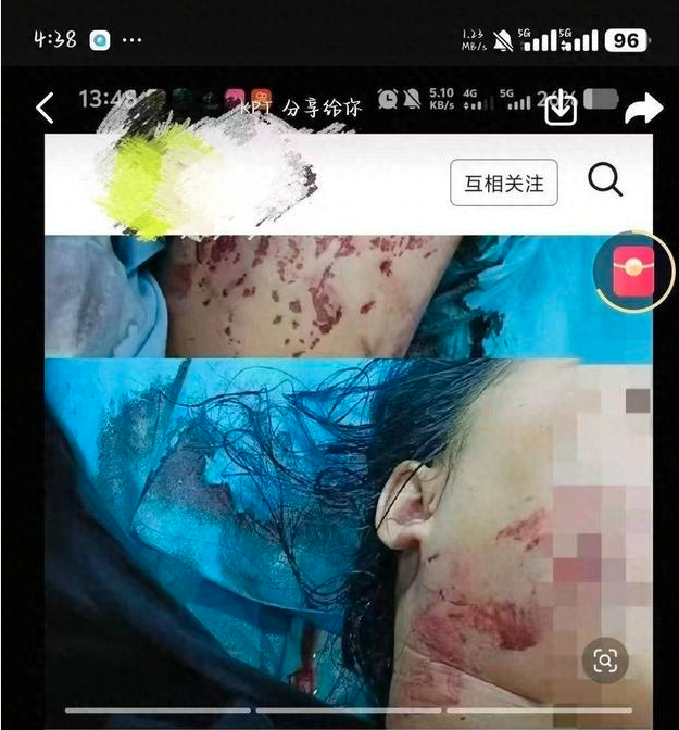 悲剧:山东小学屋顶太阳能板坠落 砸死学生 悲剧:山东小学屋顶太阳能板坠落 砸死学生