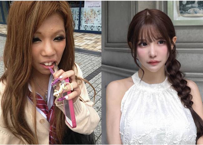砸钱翻转人生 日本模特儿公开整形“前后对比” 砸钱翻转人生 日本模特儿公开整形“前后对比”
