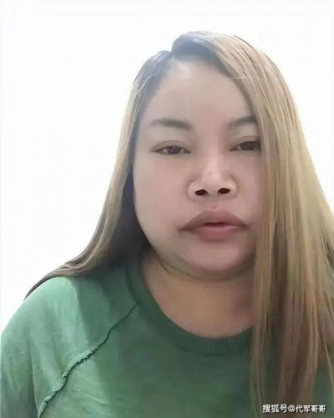 凤姐接受采访,自称病得很重 凤姐接受采访,自称病得很重