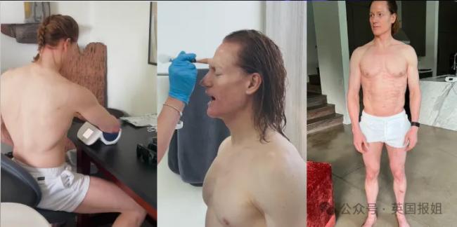 “换血”富翁又整活:这方法成功排出微塑料 “换血”富翁又整活:这方法成功排出微塑料