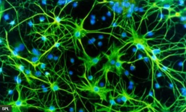 科学家首次记录临终记忆闪回脑波 科学家首次记录临终记忆闪回脑波
