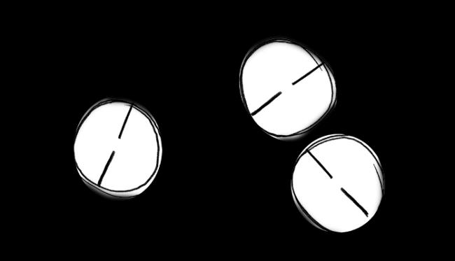 一场危机:美数百万儿童被诊断患有这种病 一场危机:美数百万儿童被诊断患有这种病