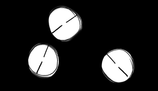一场危机:美数百万儿童被诊断患有这种病 一场危机:美数百万儿童被诊断患有这种病