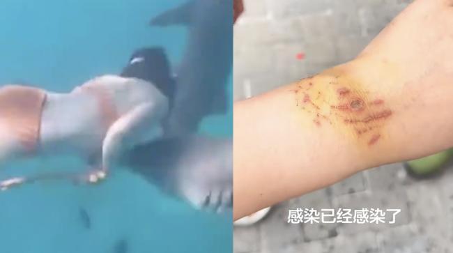 中国女游客生理期潜水 惨遭鲨鱼咬伤 中国女游客生理期潜水 惨遭鲨鱼咬伤