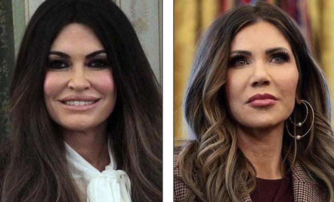 川普审美影响美整容界,医:小心整成贝索斯新妻 川普审美影响美整容界,医:小心整成贝索斯新妻