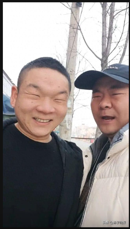 常被嘲睁眼跟闭眼一样 眯眯眼大叔动刀开眼 常被嘲睁眼跟闭眼一样 眯眯眼大叔动刀开眼