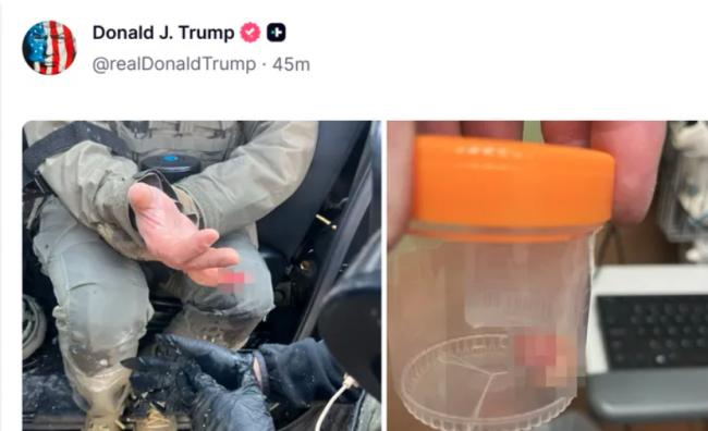 美国抗议民众咬断ICE手指 川普转发骇人画面 美国抗议民众咬断ICE手指 川普转发骇人画面