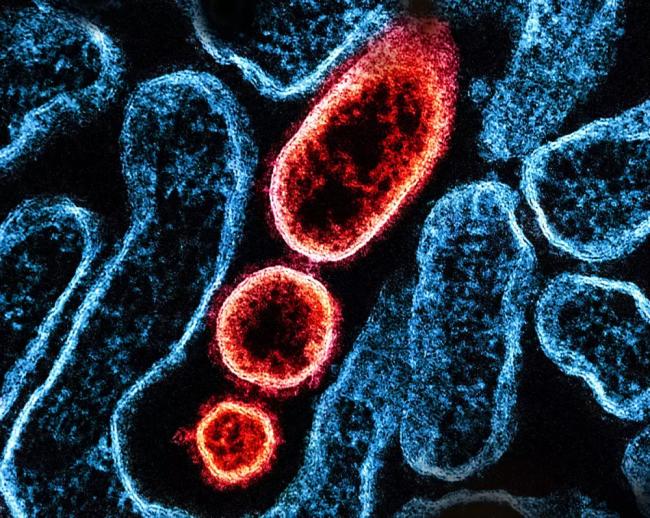 尼帕病毒会成全球大流行吗 专家谈关键一点 尼帕病毒会成全球大流行吗 专家谈关键一点