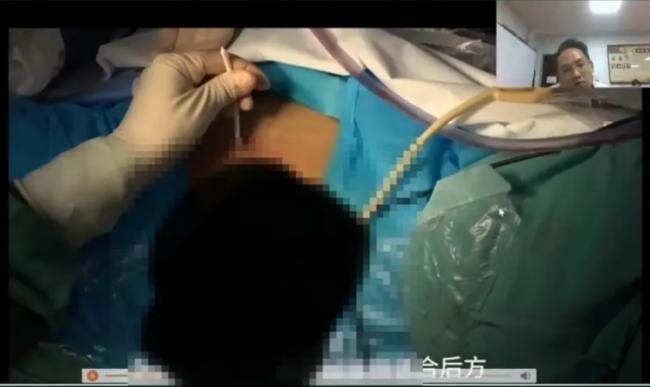 陕西医院手术直播无码暴露女患者,麻烦了 陕西医院手术直播无码暴露女患者,麻烦了