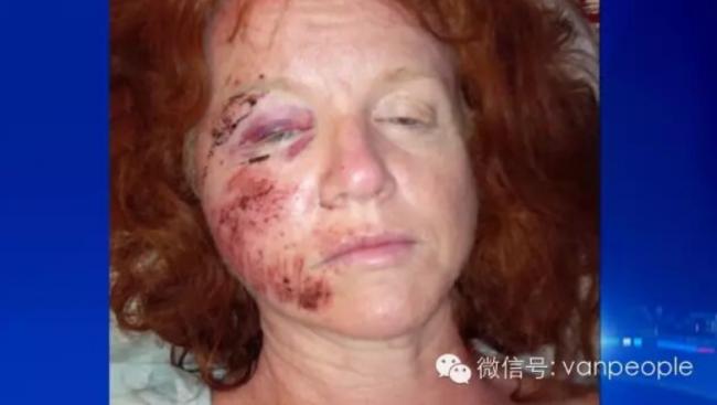 奇葩中的战斗鹅 加拿大鹅最凶残的时候到了 奇葩中的战斗鹅 加拿大鹅最凶残的时候到了