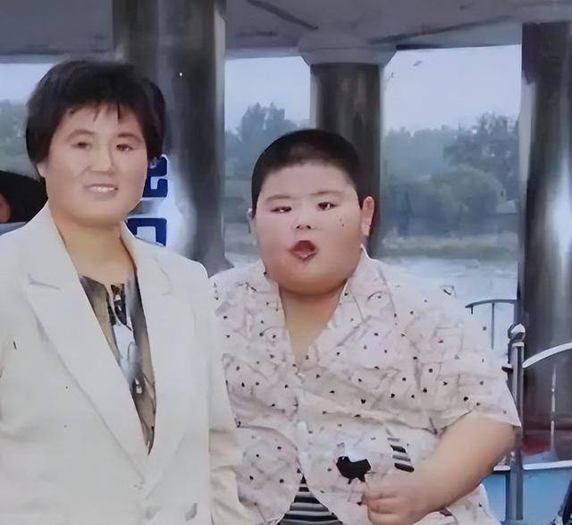 中国首胖切胃暴瘦480斤,成名后抛妻,下场曝光 中国首胖切胃暴瘦480斤,成名后抛妻,下场曝光