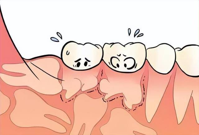 10种罕见的人体特征,拥有一个或是“天选之人” 10种罕见的人体特征,拥有一个或是“天选之人”
