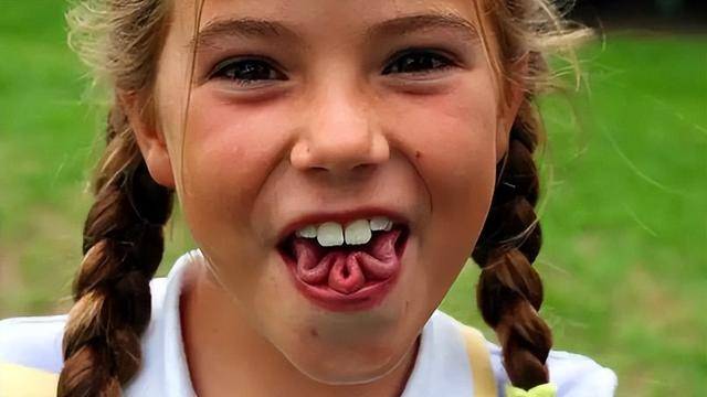 10种罕见的人体特征,拥有一个或是“天选之人” 10种罕见的人体特征,拥有一个或是“天选之人”