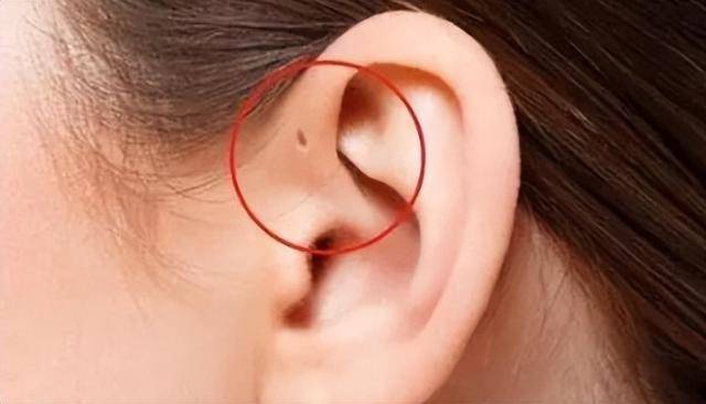 10种罕见的人体特征,拥有一个或是“天选之人” 10种罕见的人体特征,拥有一个或是“天选之人”