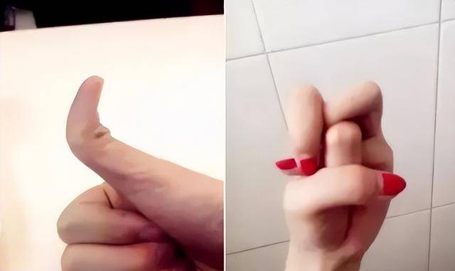 10种罕见的人体特征,拥有一个或是“天选之人” 10种罕见的人体特征,拥有一个或是“天选之人”