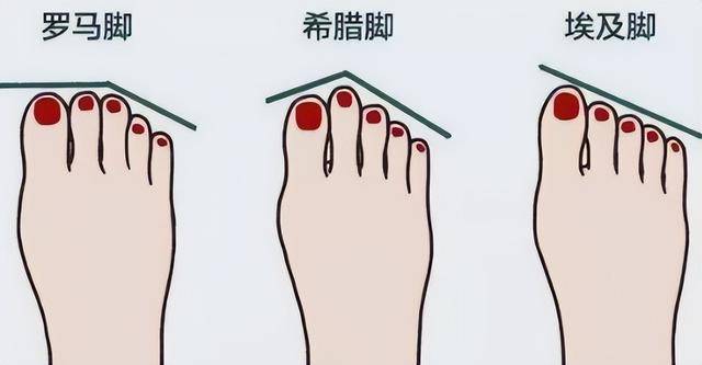 10种罕见的人体特征,拥有一个或是“天选之人” 10种罕见的人体特征,拥有一个或是“天选之人”