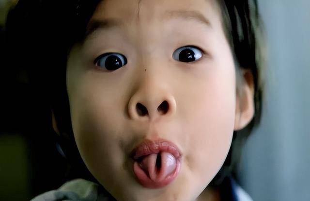 10种罕见的人体特征,拥有一个或是“天选之人” 10种罕见的人体特征,拥有一个或是“天选之人”