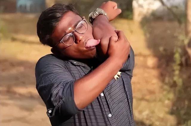 10种罕见的人体特征,拥有一个或是“天选之人” 10种罕见的人体特征,拥有一个或是“天选之人”