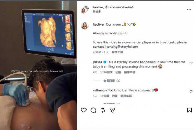 爸爸一句话 胎儿超音波露微笑 5000万人看哭 爸爸一句话 胎儿超音波露微笑 5000万人看哭