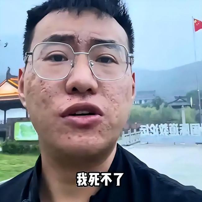 被称“全网八字最硬的男人”,如今他的面相大变 被称“全网八字最硬的男人”,如今他的面相大变