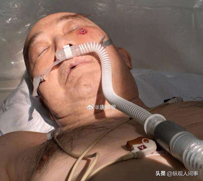 唐师曾多张病房照被公开 催人泪下 唐师曾多张病房照被公开 催人泪下