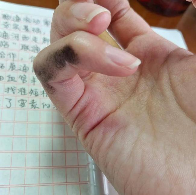一块橡皮卖了100万,小学生文具杀疯了 一块橡皮卖了100万,小学生文具杀疯了