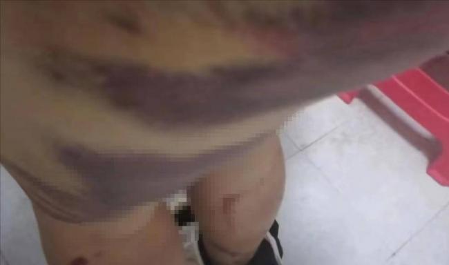 电诈亲历者:没姿色的女子,最终下场是公海 电诈亲历者:没姿色的女子,最终下场是公海