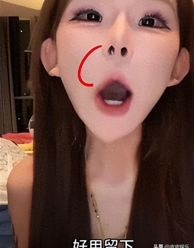 能被自己臭醒...中国网红分享整容后遗症 能被自己臭醒...中国网红分享整容后遗症