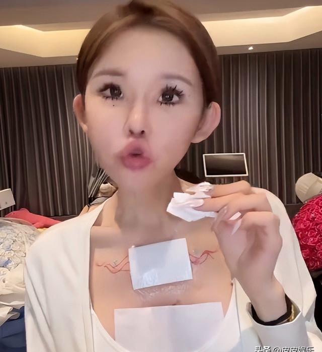 能被自己臭醒...中国网红分享整容后遗症 能被自己臭醒...中国网红分享整容后遗症