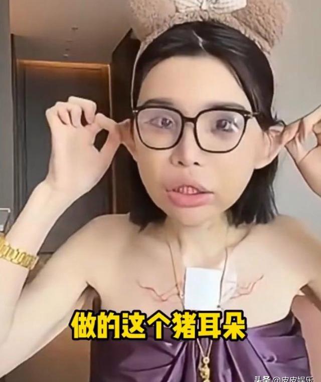 能被自己臭醒...中国网红分享整容后遗症 能被自己臭醒...中国网红分享整容后遗症