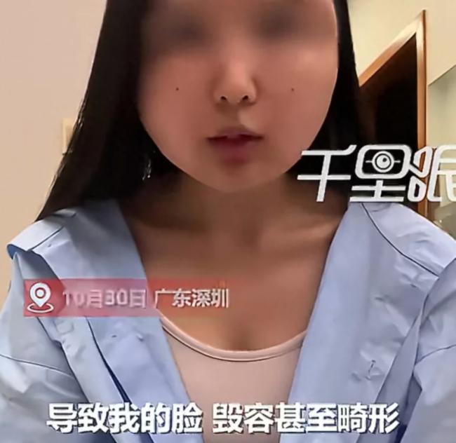深圳女子打了100组生长因子 面部“馒化”畸形 深圳女子打了100组生长因子 面部“馒化”畸形